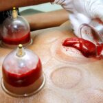 SAKARYAHACCAME — hacamat — SERDİVAN ARABACI ALANI MAHALLESİ