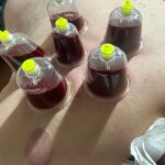 SAKARYAHACCAME — hacamat — SERDİVAN ARABACI ALANI MAHALLESİ